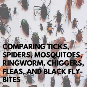 Comparing Ticks, Spiders, Mosquitoes, Ringworm, Chiggers, Fleas, And Black Fly-Bites